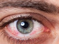 خطر ویروس کرونا برای چشم‌ها چیست؟