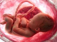 انتقال کرونا از مادر به جنین ممکن است؟