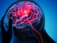 ۷ عامل اصلی که باعث بروز سکته مغزی می‌شود