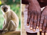 پاسخ به ۱۴ سوال مهم درباره آبله میمون