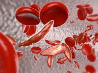 نشانه‌های کم خونی در زنان