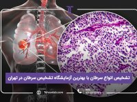 تشخیص انواع سرطان با بهترین آزمایشگاه تشخیص سرطان در تهران