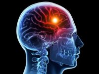 کدام گروه از مردان بیشتر در معرض سکته مغزی هستند؟