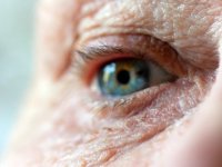 کدام تغییرات چشمی علائم اولیه آلزایمر هستند؟