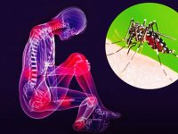 ویروس «چیکونگونیا»، علائم و راه‌های تشخیص