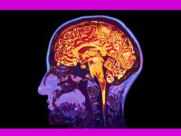 اختلالات عجیب مغزی را بشناسید