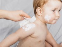 انواع عفونت‌ پوستی در کودکان