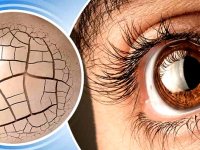 خشکی چشم؛ علل و راهکارهای درمان