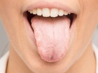 علت سفیدی زبان چیست و چطور می توان آن را برطرف کرد؟