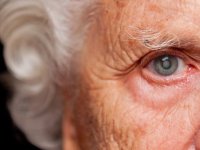درمان آب سیاه چشم در خانه؛ از پیشگیری تا درمان طبیعی در منزل