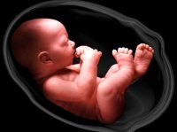 دلایل ژنتیکی سقط جنین